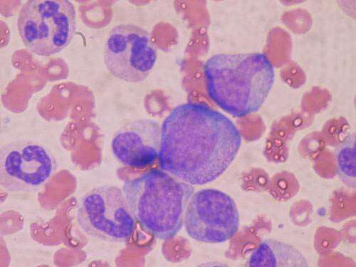 Researchers develop method to diagnose aplastic anemia more effectively