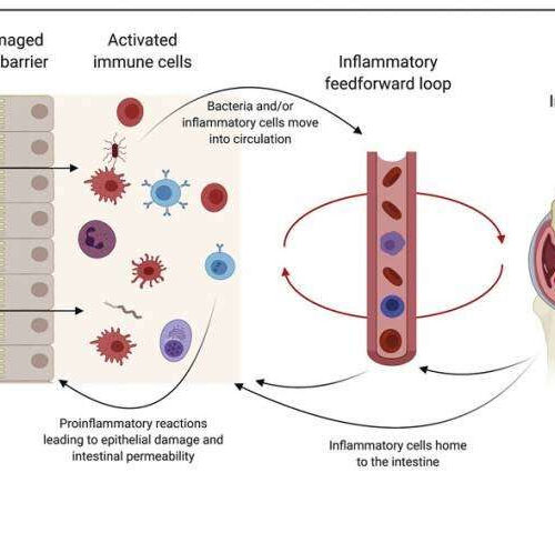 Targeting the gut to relieve rheumatoid arthritis