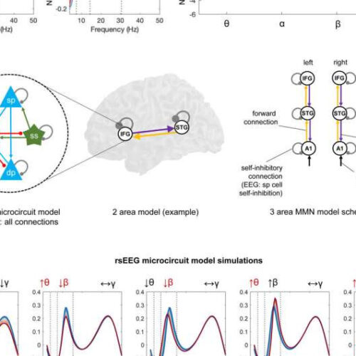 Synaptic dysfunction in schizophrenia