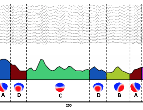 Autism: a spectrum on the path to segmentation