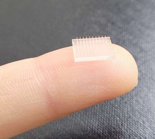 A 3D printed vaccine patch offers vaccination without a shot