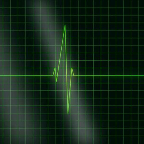 Heart rhythm disorders: A cardiologist shares five things it’s important to know
