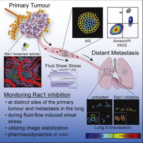 Advanced imaging reveals breast cancer’s Achilles’ heel