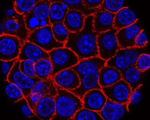 Link between inflammation and pancreatic cancer development uncovered