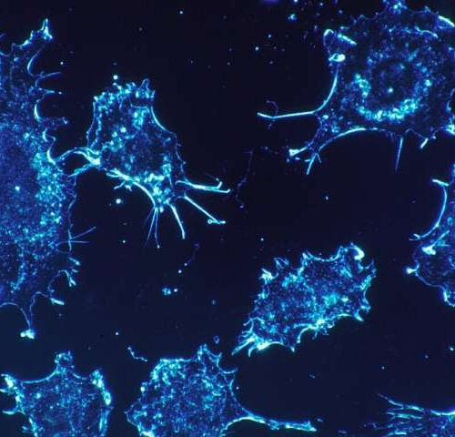 Cancer cells’ unexpected genetic tricks for evading the immune system