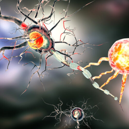 Protein discovery pulls at the roots of recurring brain cancer