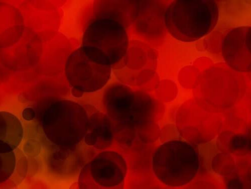 Hydroxyurea may reverse sickle cell-related heart abnormalities