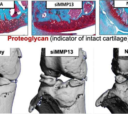 Biomedical engineers demonstrate potential for the first clinically successful osteoarthritis drug