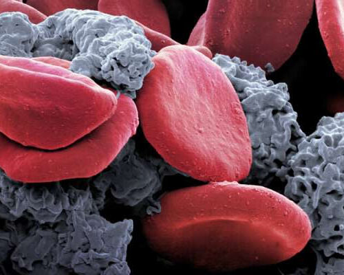 Physical exercise can relieve tumor-associated anemia