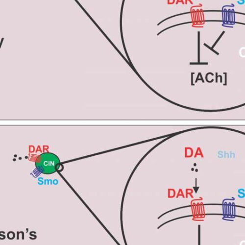 Study suggests sonic hedgehog protein pathway stimulation could help Parkinson’s patients