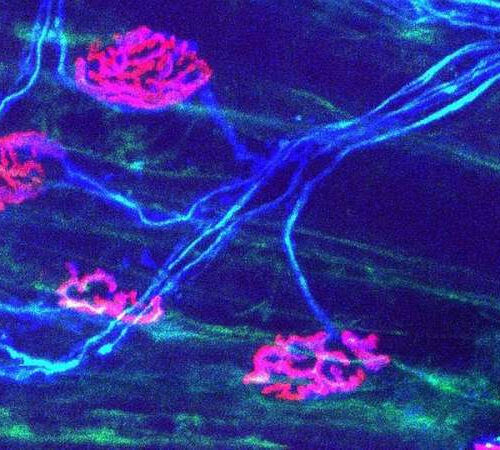 Altering metabolism in immune cells helps damaged nerves recover