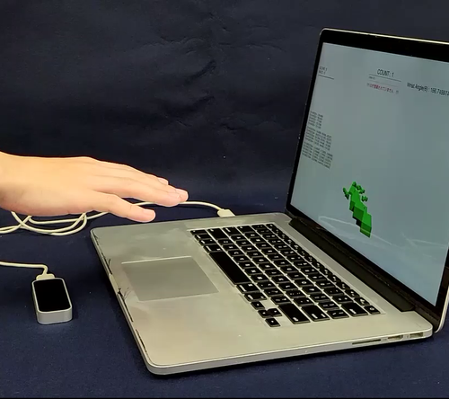 Cervical myelopathy screening focusing on finger motion using noncontact sensor