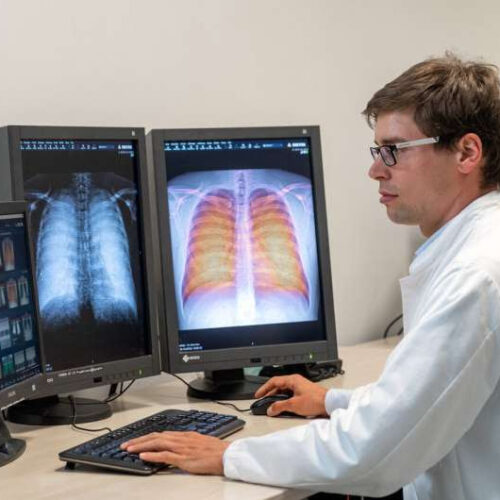 Dark-field X-ray technology improves diagnosis of pulmonary ailments