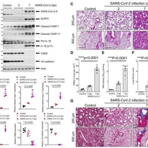 Mitigating lung damage, mortality due to SARS-CoV-2