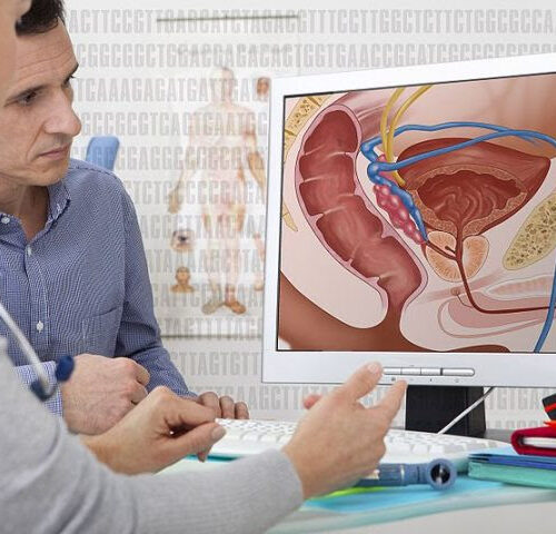 Newly Approved Prostate Cancer Scan Can Detect Cells that Have Spread to Lymph Nodes