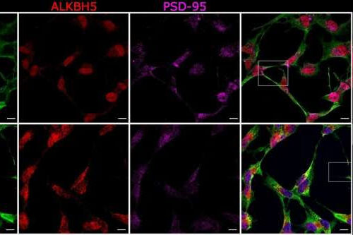 Scientists gain new understanding of how brain cells talk