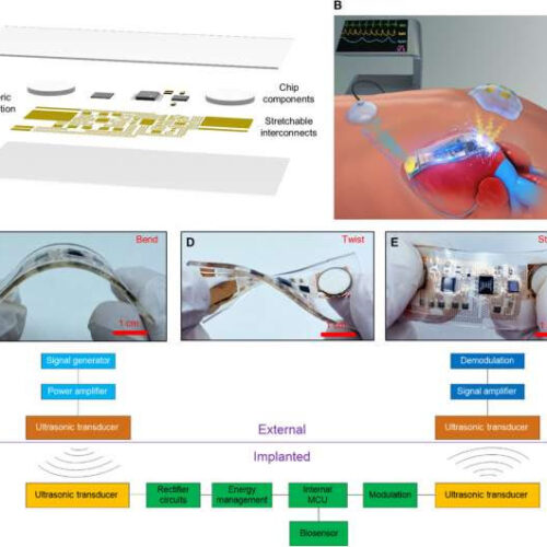 Simultaneous acoustic energy transfer and communication in neuroscience and cardiovascular medicine