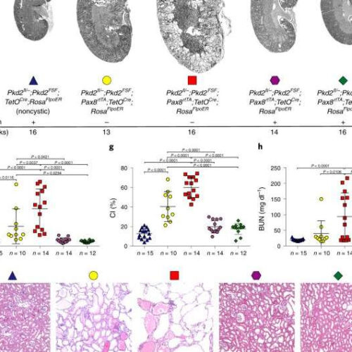 Study: Genetic kidney disorder reversible in preclinical models