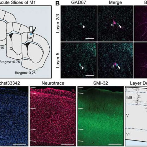 Study reveals motor cortex could have larger role in Parkinson’s disease