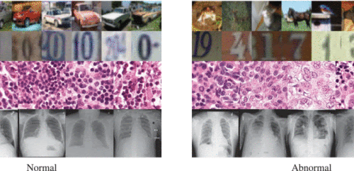 Artificial intelligence spots anomalies in medical images