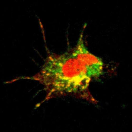 How COVID-19 alters the immune system