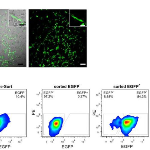 Researchers identify stem cell population key for bone regeneration