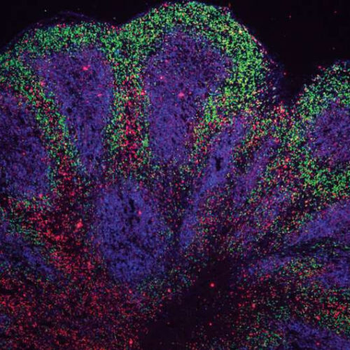 Lab-grown ‘mini brains’ hint at potential treatment options for motor neurone disease and frontotemporal dementia