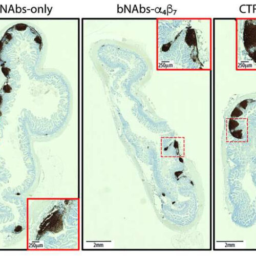 A page from the COVID therapy playbook: Unleashing a flood of neutralizing antibodies against HIV