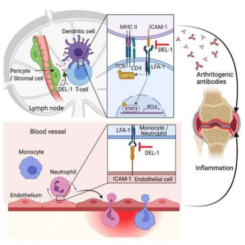 A two-pronged approach to keep rheumatoid arthritis in check