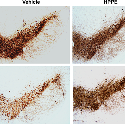 Deterioration of brain cells in Parkinson’s disease is slowed by blocking the Bach1 protein, preclinical study shows