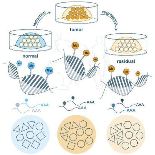 Metabolic memory plays a key role in breast cancer relapse