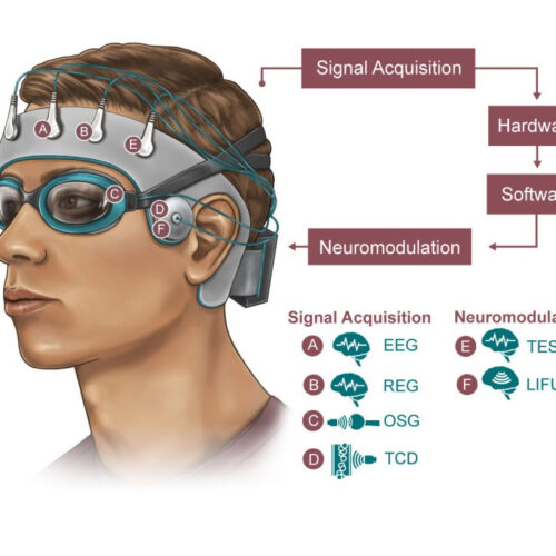 Brain-cleaning sleeping cap gets US Army funding