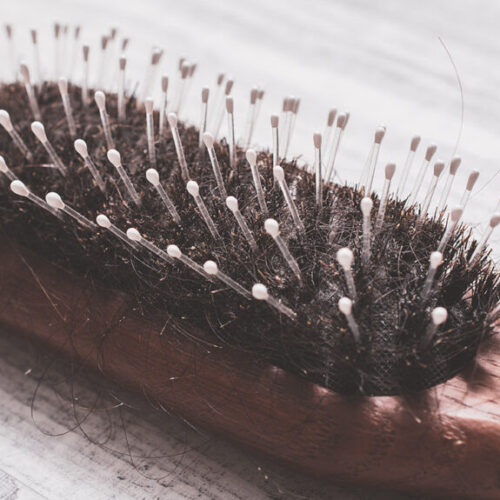 Hair loss after weight loss: What is the connection?