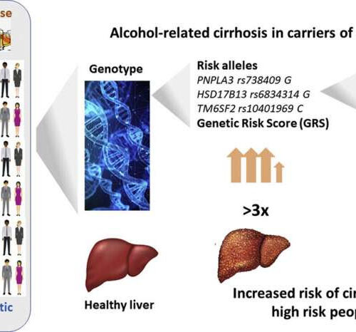 Genetic risk test developed to predict alcohol-related cirrhosis of the liver