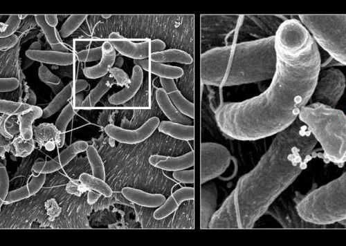 War in the gut: How human microbiota resist the cholera bacterium