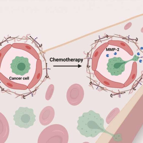 Chemo helps breast cancer cells to spread and attach to blood vessel linings in the lungs