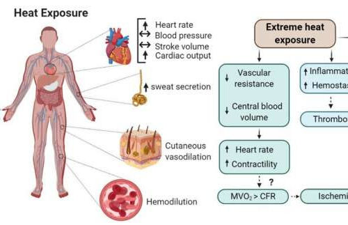 Experts warn that extreme heat events jeopardize cardiovascular health