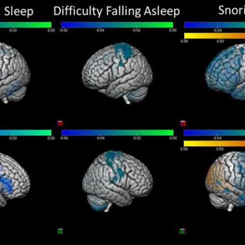 Inadequate sleep is bad for preteens’ brains