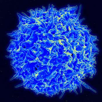 Knocking out specific gene prevents T-cell exhaustion, boosts CAR T-cell responses