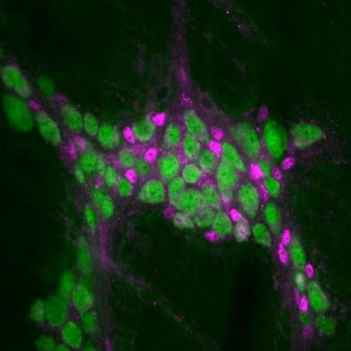 Microbiome discovery may open new doors to development of treatments for gastrointestinal diseases