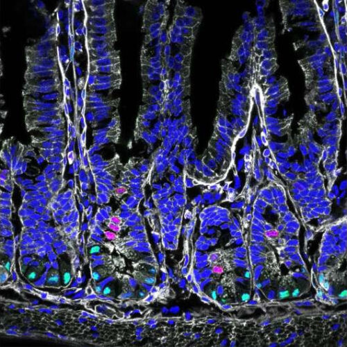 New link between diet, intestinal stem cells and disease discovered