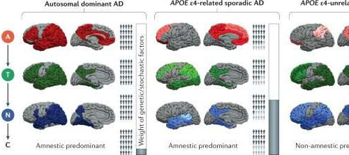 New framework for analyzing Alzheimer’s disease identifies not one form, but three