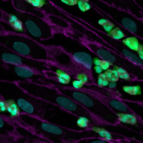 Cystic fibrosis faithfully modeled in a human Lung Airway Chip