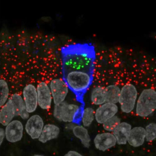 Researchers find that SARS-CoV-2 infects sustentacular cells in the olfactory epithelium of COVID-19 patients