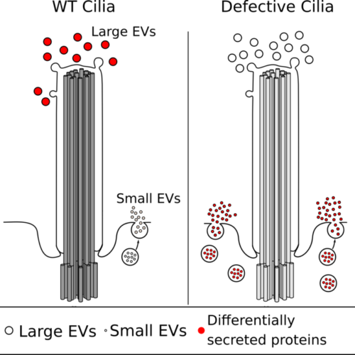 Ciliopathies: Tiny filament projections from cells send out false signals