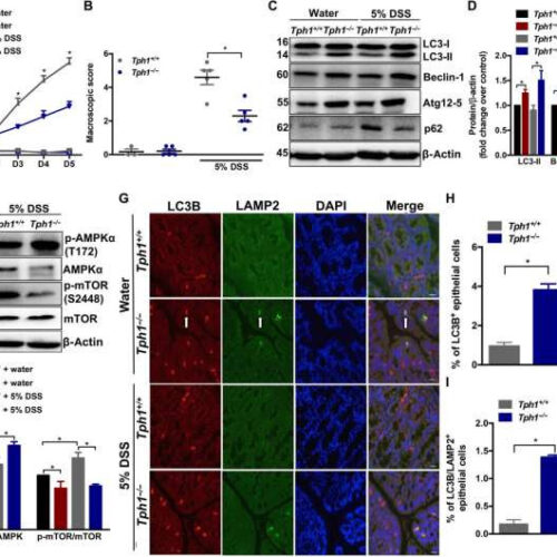 Scientists pinpoint key trigger of Crohn’s disease