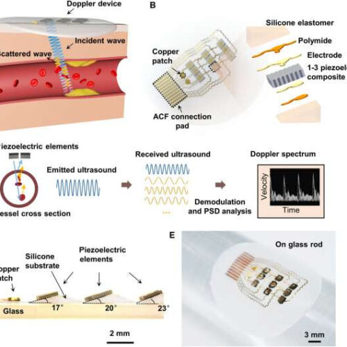 Monitoring blood flow velocity with a flexible Doppler ultrasound device