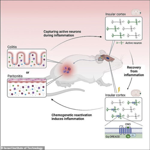 Scientists have figured out that the brain’s insurlar cortex can make a person sick by storing and retrieving episodes of past inflammations throughout the body