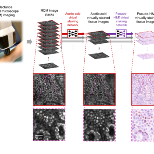 New imaging technology developed by UCLA research team may reduce need for skin biopsies