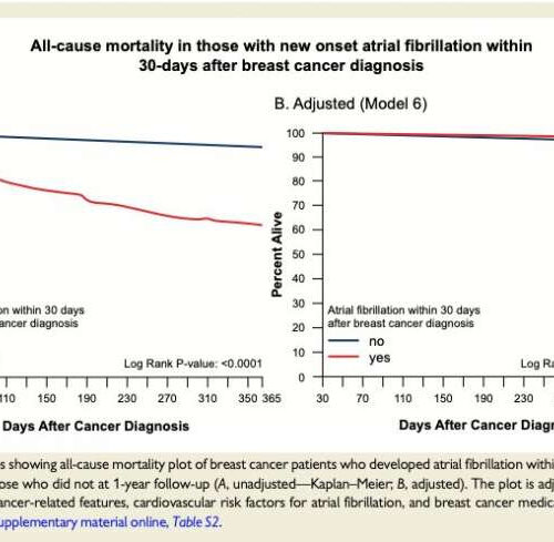 Atrial fibrillation and death are more common during the first year after breast cancer diagnosis